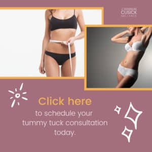 Schedule a tummy tuck consultation
